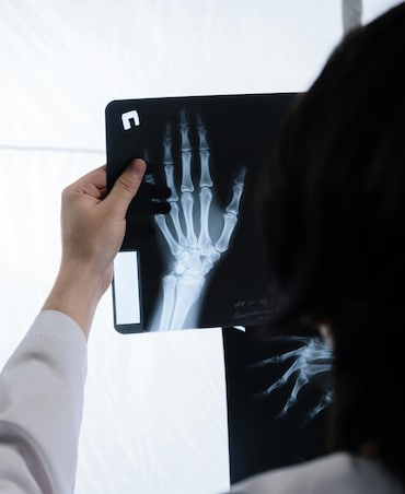 Causes Of Muscle Loss After 30