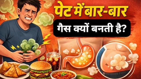क्यों बनती है बार-बार गैस? खराब पेट नहीं ये हो सकती है वजह...