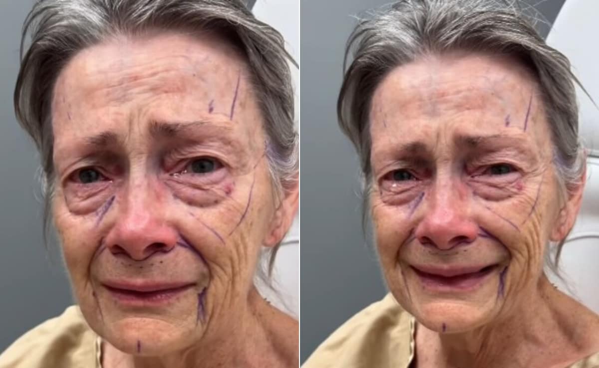 70 की उम्र में 40 जैसी दिखने लगी महिला! कुछ ही हफ्तों में बदला चेहरा, ट्रांसफॉर्मेशन ने उड़ाए होश