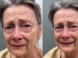 70 की उम्र में 40 जैसी दिखने लगी महिला! कुछ ही हफ्तों में बदला चेहरा, ट्रांसफॉर्मेशन ने उड़ाए होश