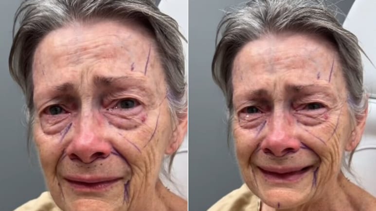 70 की उम्र में 40 जैसी दिखने लगी महिला! कुछ ही हफ्तों में बदला चेहरा, ट्रांसफॉर्मेशन ने उड़ाए होश