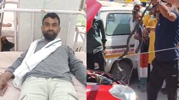 सांप पकड़ने के बाद... कार में ले जा रहे सांप ने युवक को डसा, अस्पताल में चल रहा इलाज
