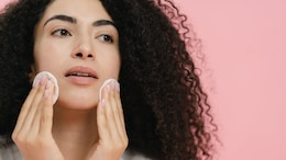 Nutritionist Reveals 6 Diet Changes That May Help Reduce Acne Naturally