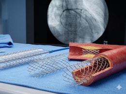 Centre Revises Coronary Stent Prices From April 2026: Here's How Much It Should Cost You Now