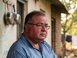 Got A Buffalo Hump? How It Is A Sign Of A Hidden Health Condition