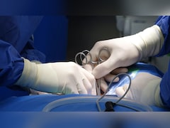 छोटी सी सर्जरी में भी लापरवाही कर बैठे डॉक्टर, एक चूक और निकल दिया पूरा का पूरा लिवर