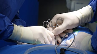 छोटी सी सर्जरी में भी लापरवाही कर बैठे डॉक्टर, एक चूक और निकल दिया पूरा का पूरा लिवर