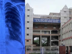 दिल्ली के डॉक्टरों ने तो रिकॉर्ड बना दिया,दाईं ओर धड़क रहा था दिल,छाती की हड्डी काटे बिना कर दी सर्जरी