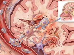 Kerala Health Minister Urges Caution Against "Brain-Eating Amoeba": See Symptoms And Precautions