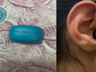 कान में फट गए ईयरबड्स! MBBS स्टूडेंट का पोस्ट सोशल मीडिया पर वायरल