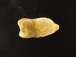 700 साल पुरानी ममी के दांत ने खोला 'मौत' का राज, वैज्ञानिकों ने बदल डाली मेडिकल हिस्ट्री!