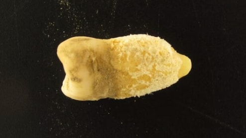 700 साल पुरानी ममी के दांत ने खोला 'मौत' का राज, वैज्ञानिकों ने बदल डाली मेडिकल हिस्ट्री!