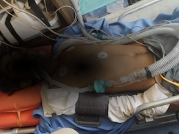 भिवाड़ी में नाबालिग को 'थर्ड डिग्री' देने का आरोप, वेंटिलेटर पर मासूम; SHO समेत 4 पर केस दर्ज