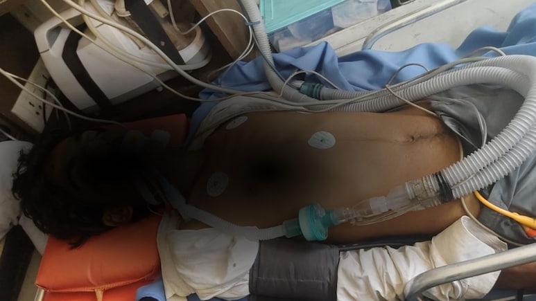 भिवाड़ी में नाबालिग को 'थर्ड डिग्री' देने का आरोप, वेंटिलेटर पर मासूम; SHO समेत 4 पर केस दर्ज