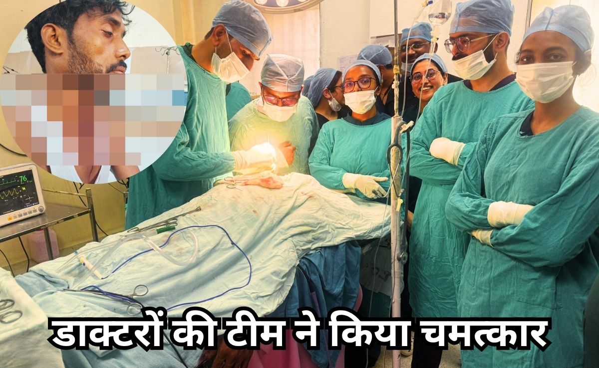 गले के आर- पार हुआ 11 इंच लंबा सरिया, डाक्टरों की टीम ने जटिल ऑपरेशन कर सफलतापूर्वक निकाला