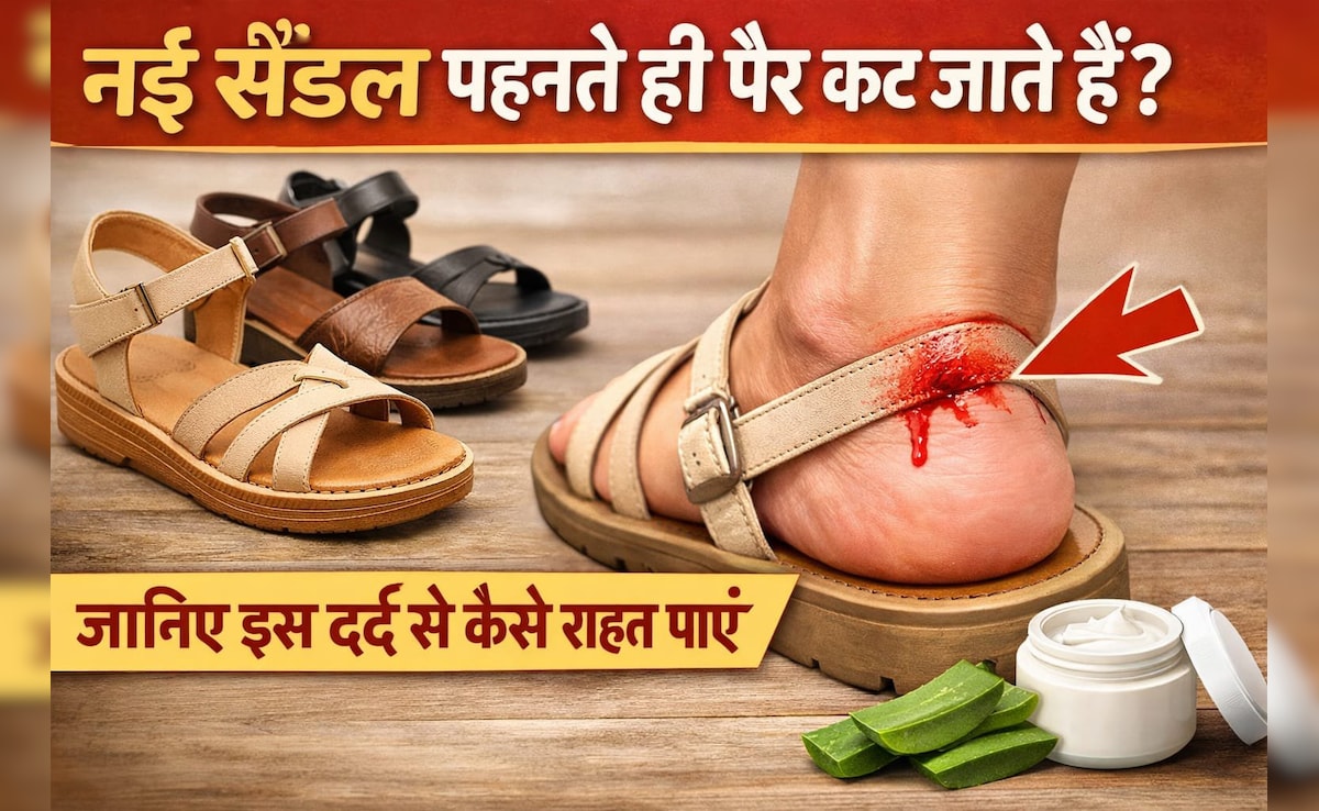 नई सैंडल पहनते ही पैर कट जाता है? ये ट्रिक्स अपनाएं और इस दर्द से राहत पाएं