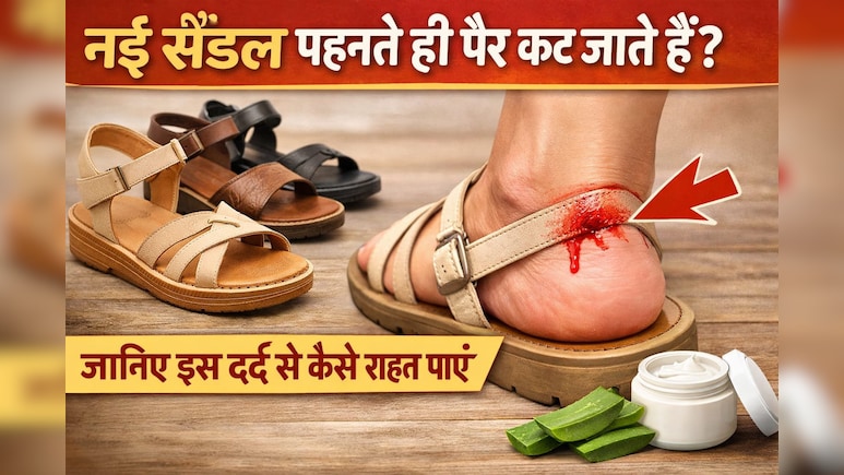 नई सैंडल पहनते ही पैर कट जाता है? ये ट्रिक्स अपनाएं और इस दर्द से राहत पाएं