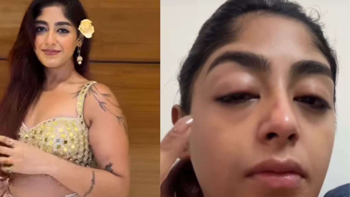 <i>Splitsvilla</i> 16 Contestant Alleges Physical Assault In Mumbai Club, Shares Video: 'Tooth Broke, Face Swelled Up'