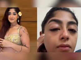 <i>Splitsvilla</i> 16 Contestant Alleges Physical Assault In Mumbai Club, Shares Video: 'Tooth Broke, Face Swelled Up'
