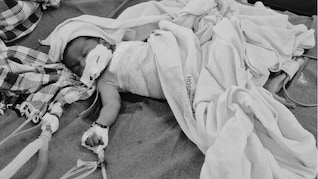 झोपड़ी में सो रहे मासूम को उठा ले गए आवारा कुत्ते, बुरी तरह नोचकर फाड़ डाला पेट