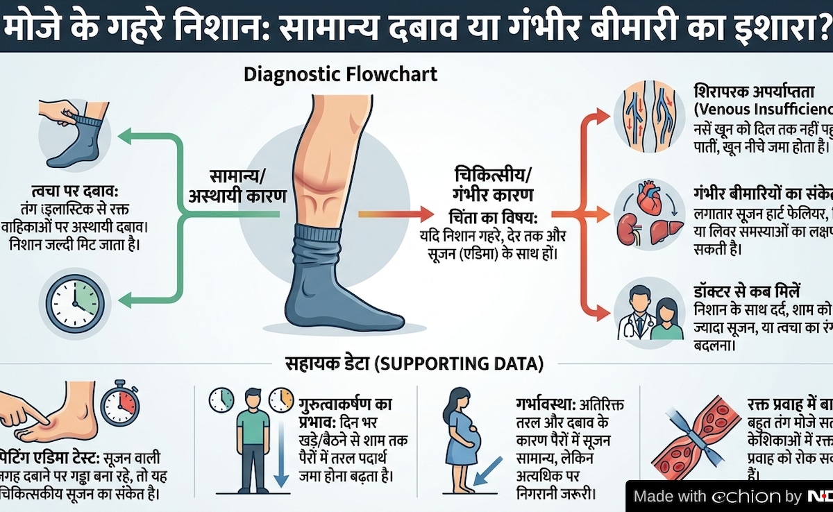 Latest and Breaking News on NDTV