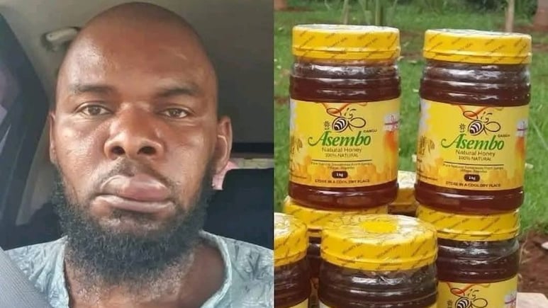 गजब की मार्केटिंग! शहद असली है या नकली? बंदे का सूजा हुआ चेहरा दे रहा है गवाही