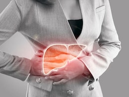 No Alcohol, Lose Weight, And Sip Coffee: A Hepatologist's Guide To Better Liver Health