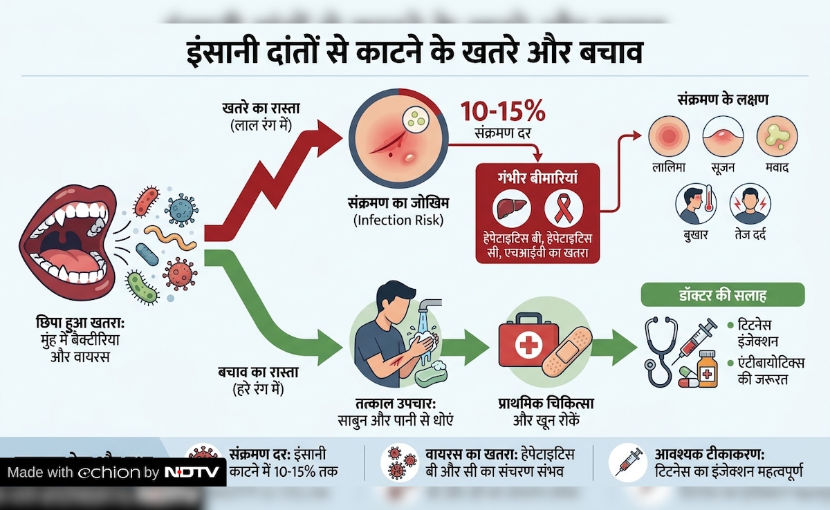 Latest and Breaking News on NDTV