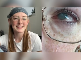 A 20-Year-Old Woman Wore Contact Lenses To The Shower. She Went Blind