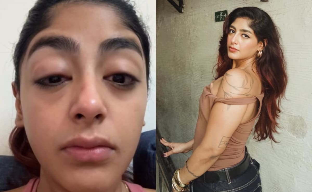 Splitsvilla 16 फेम प्रीत सिंह के साथ मुंबई में मारपीट, टूटा दांत और सूजी आंखें, शेयर किया दर्दनाक वीडियो