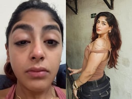 Splitsvilla 16 फेम प्रीत सिंह के साथ मुंबई में मारपीट, टूटा दांत और सूजी आंखें, शेयर किया दर्दनाक वीडियो