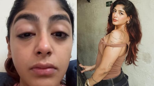 Splitsvilla 16 फेम प्रीत सिंह के साथ मुंबई में मारपीट, टूटा दांत और सूजी आंखें, शेयर किया दर्दनाक वीडियो