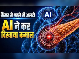 अब कैंसर नहीं करेगा सरप्राइज अटैक, पैंक्रियाटिक कैंसर को लक्षण दिखने से 3 साल पहले पकड़ लेगा AI