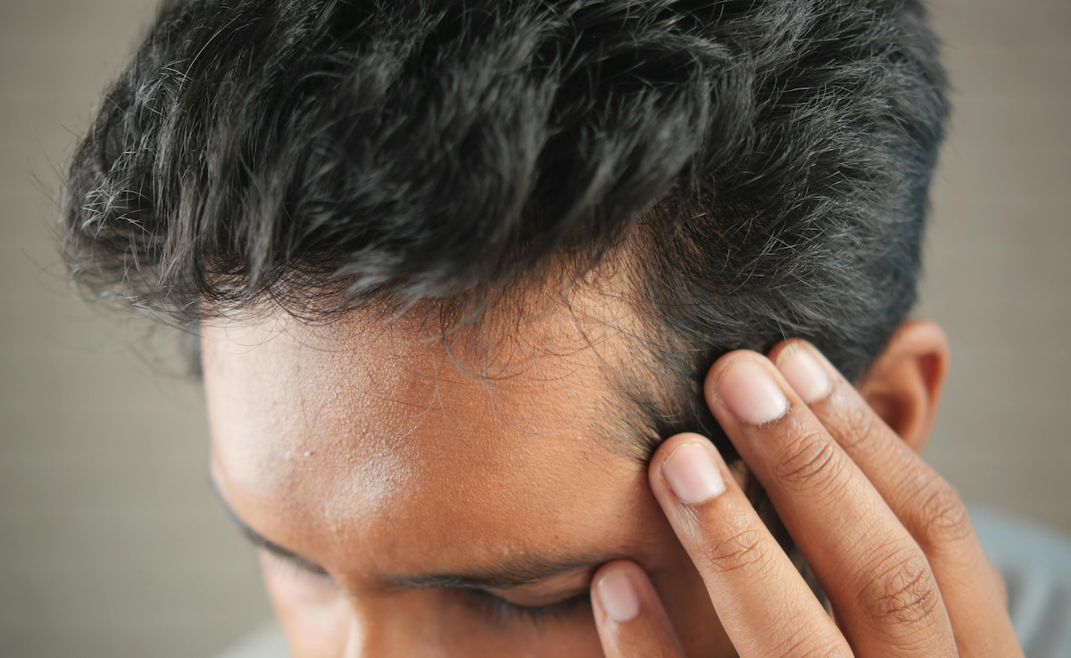 The Pill That Claims To Stop Men From Going Bald