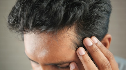 The Pill That Claims To Stop Men From Going Bald