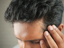 Receding Hairline vs Maturing Hairline: How To Tell The Difference?