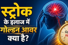 जिम जानें वालों में क्यों बढ़ रहा ब्रेन स्ट्रोक का खतरा? क्या सर्जरी से पूरी तरह ठीक हो सकता है मरीज? जानें क्या कहते हैं डॉक्टर