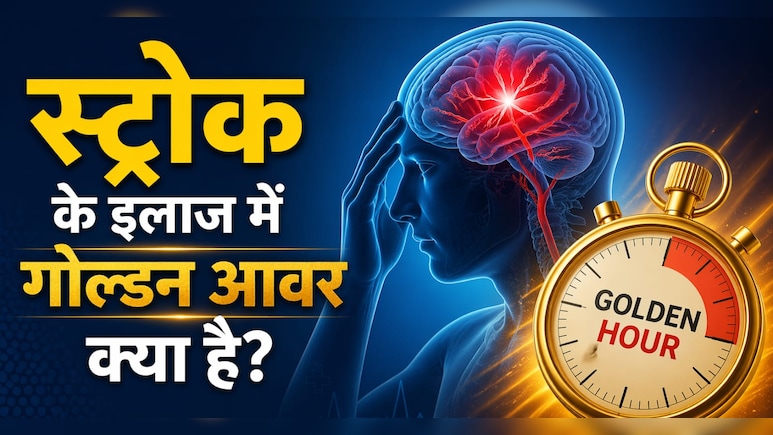 जिम जानें वालों में क्यों बढ़ रहा ब्रेन स्ट्रोक का खतरा? क्या सर्जरी से पूरी तरह ठीक हो सकता है मरीज? जानें क्या कहते हैं डॉक्टर