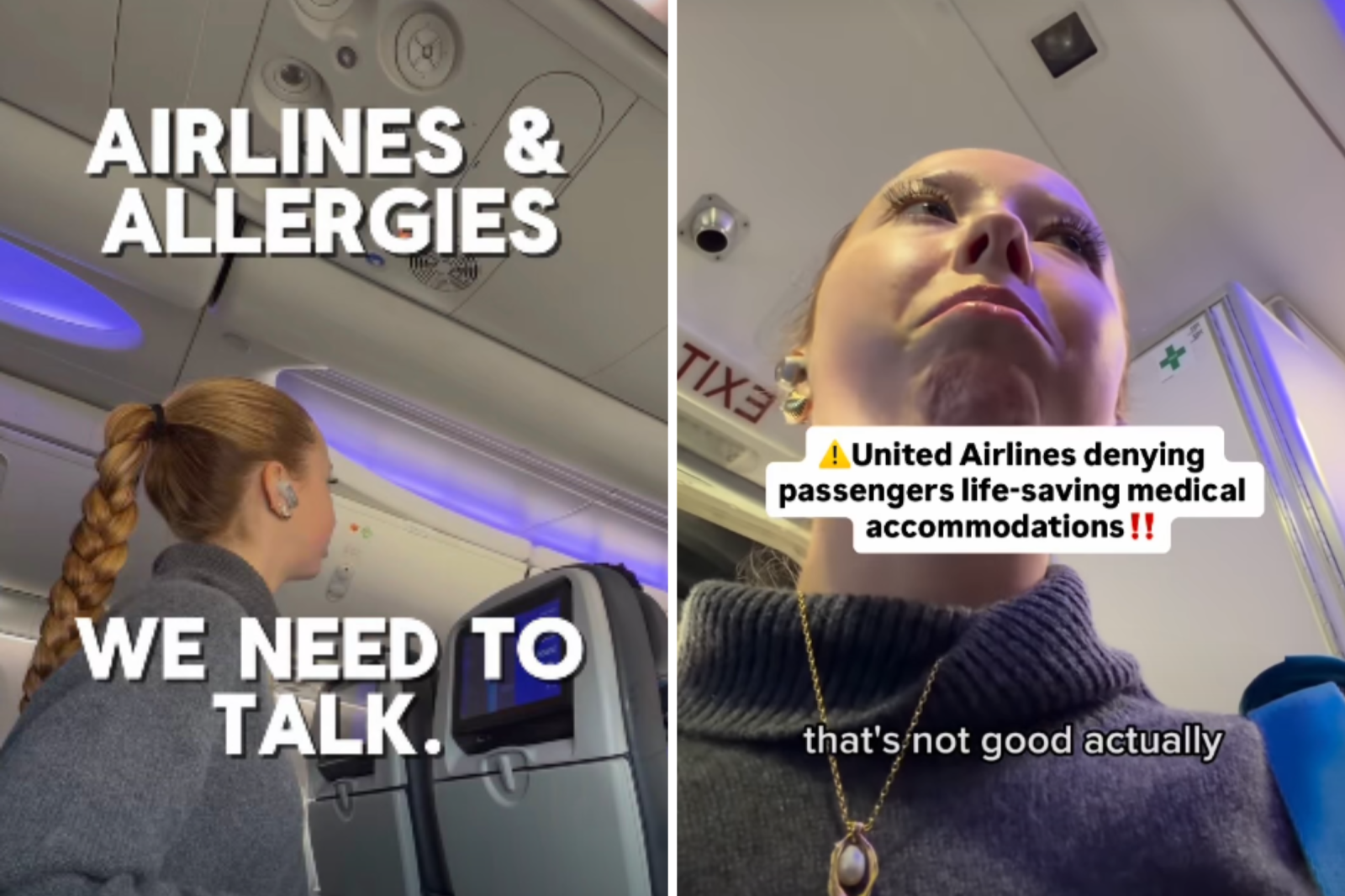 Flyer Blasts United Airlines For Ignoring Her Severe Peanut Allergy