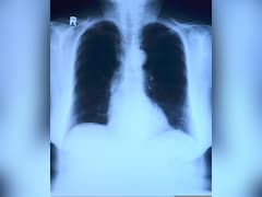 AI May Be Guessing X-Ray Results, Not Reading Them: Study