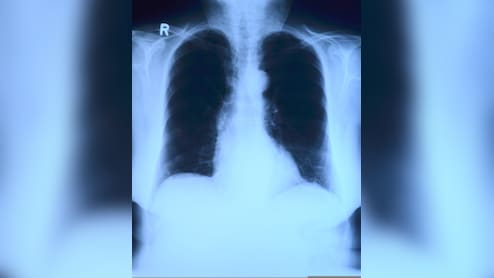 AI May Be Guessing X-Ray Results, Not Reading Them: Study
