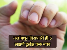 Health Tips: नखे सांगतील तुमच्या आरोग्याचे गुपित! 'ही' 5 लक्षणे दुर्लक्ष करणे महागात पडेल; वेळीच व्हा सावध