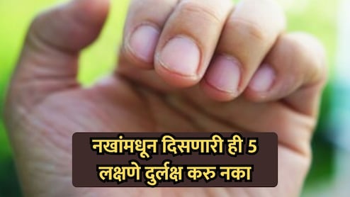 Health Tips: नखे सांगतील तुमच्या आरोग्याचे गुपित! 'ही' 5 लक्षणे दुर्लक्ष करणे महागात पडेल; वेळीच व्हा सावध
