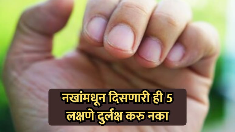 Health Tips: नखे सांगतील तुमच्या आरोग्याचे गुपित! 'ही' 5 लक्षणे दुर्लक्ष करणे महागात पडेल; वेळीच व्हा सावध