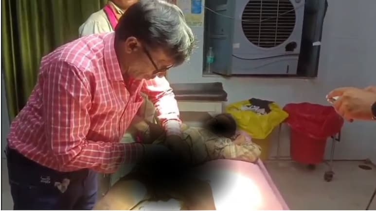 Satna: 6 साल के मासूम के प्राइवेट पार्ट में घुसा सरिया, मेडिकल कॉलेज के डॉक्टरों ने ऑपरेशन कर बचाई जान