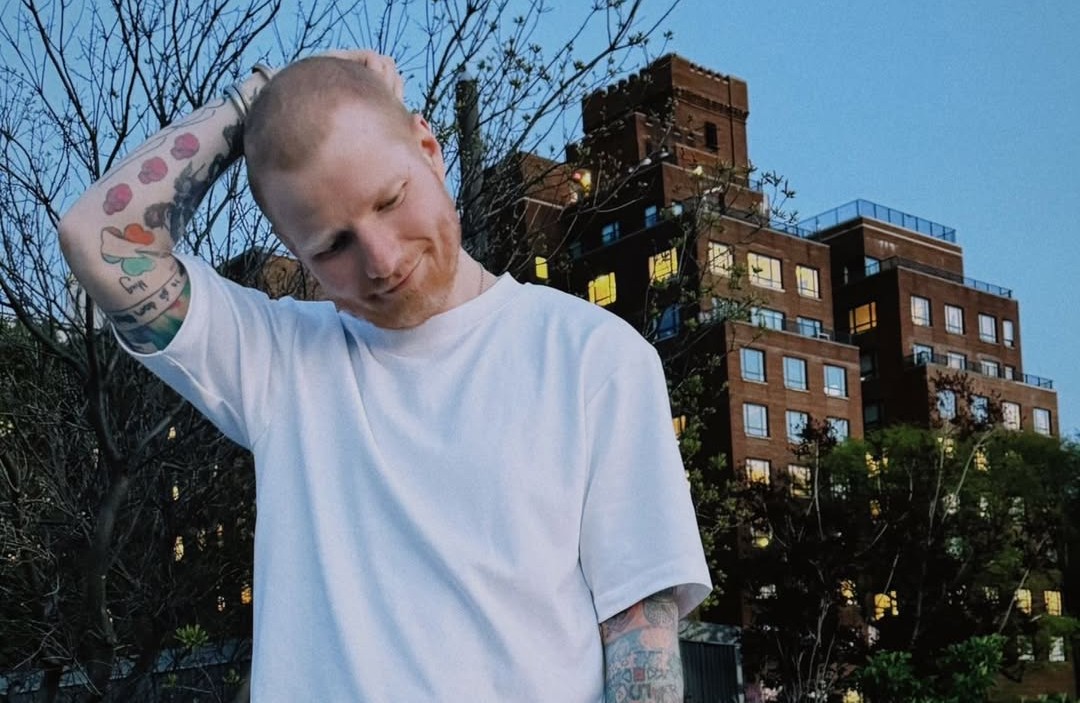 Ed Sheeran Reveals Shingles Diagnosis: Signs, Risk Factors Explained