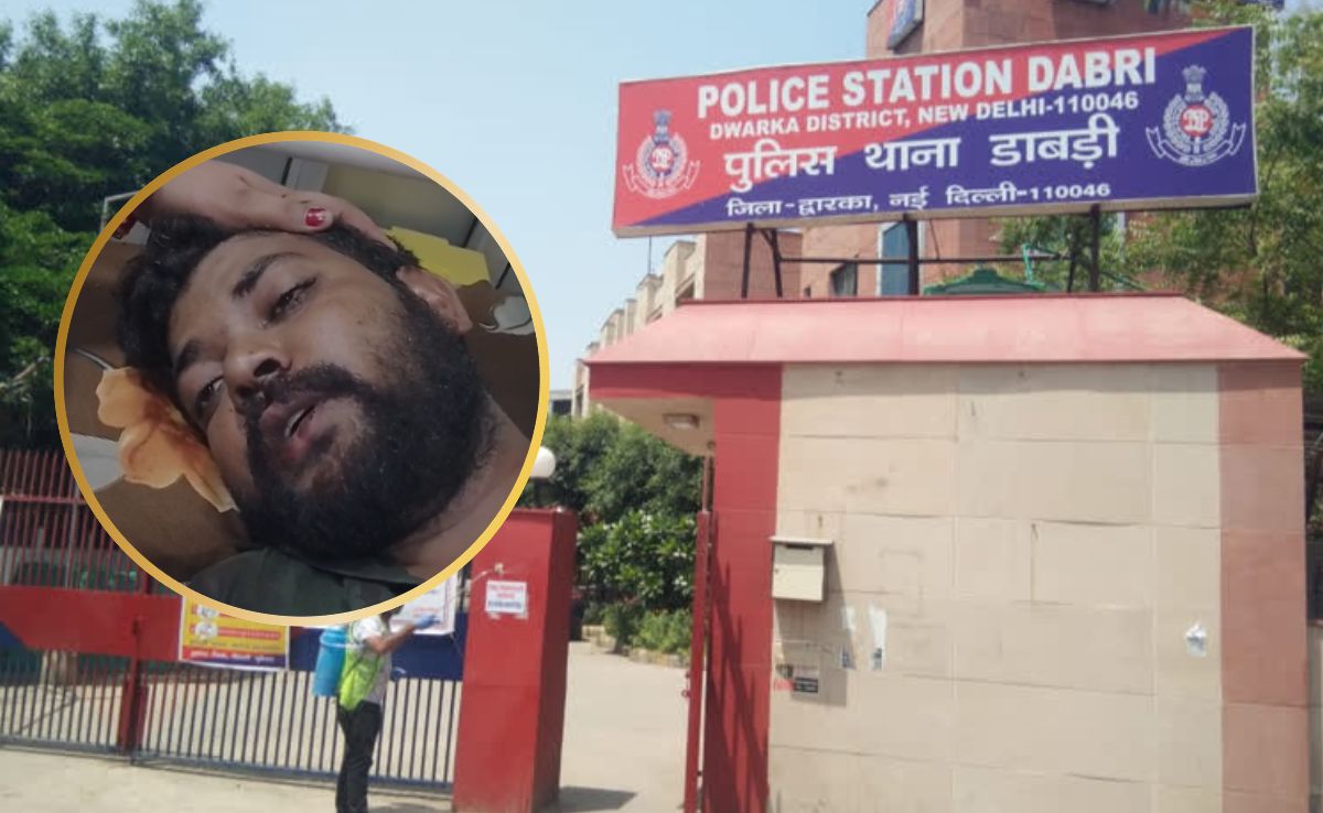 शादी के बाद हलवाई ने पेमेंट मांगा तो ग्राइंडर से हाथ काटे! दुल्‍हन के प‍िता ने की हैवान‍ियत