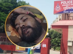 शादी के बाद हलवाई ने पेमेंट मांगा तो ग्राइंडर से हाथ काटे! दुल्‍हन के प‍िता ने की हैवान‍ियत