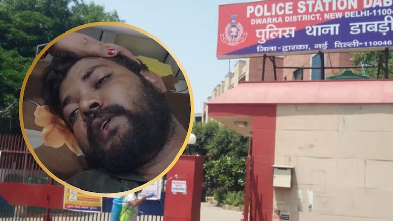 शादी के बाद हलवाई ने पेमेंट मांगा तो ग्राइंडर से हाथ काटे! दुल्&zwj;हन के प&zwj;िता ने की हैवान&zwj;ियत