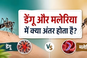 डेंगू और मलेरिया में क्या अंतर होता है? कौन-सा मच्छर फैलाता है डेंगू और मलेरिया? जानिए इलाज, लक्षण और बचाव के तरीके